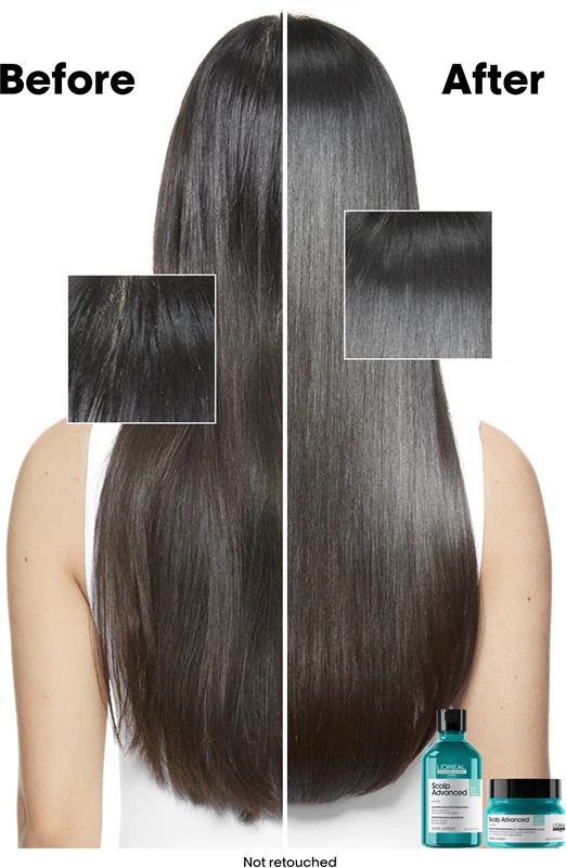 Shampoo de limpeza avançada L'Oréal Professionnel Serie Expert Scalp para couro cabeludo oleoso