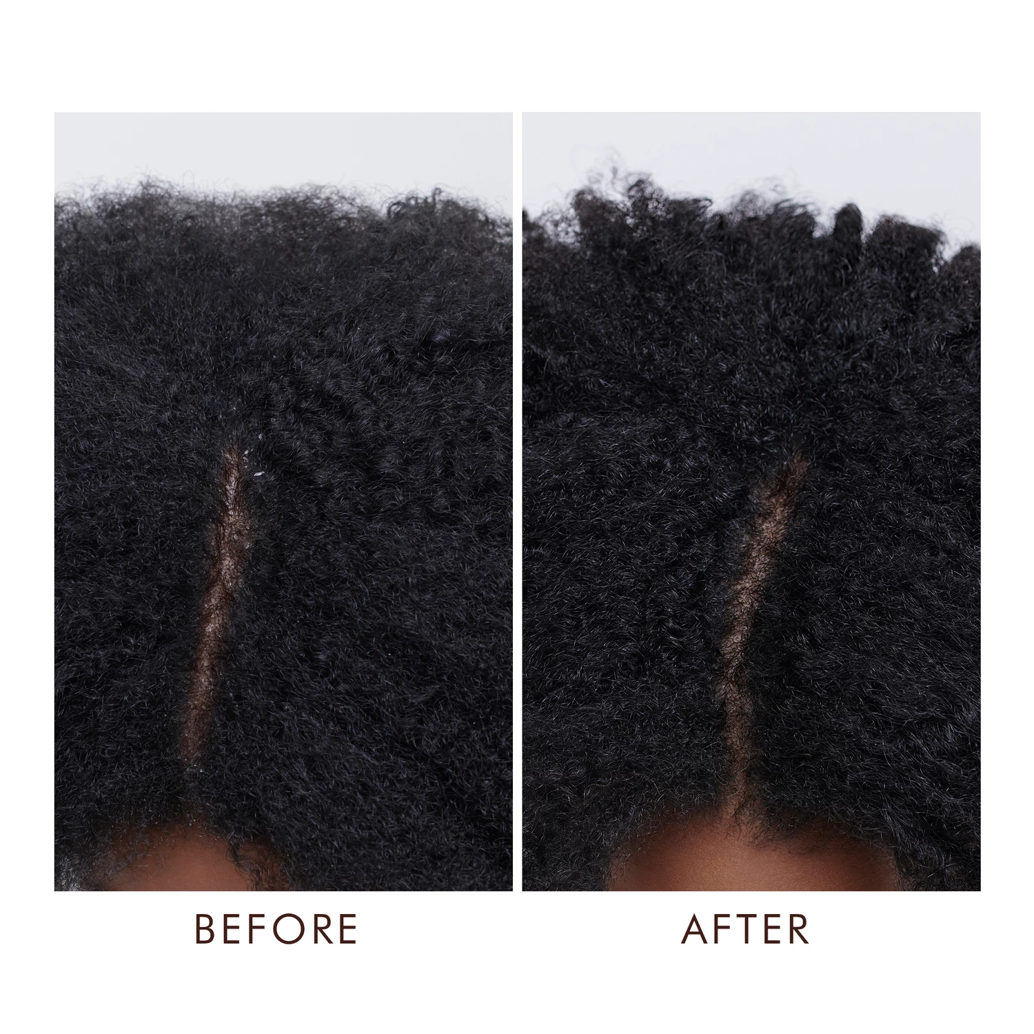 Tretman za suho vlasište 45 ml - Moroccanoil