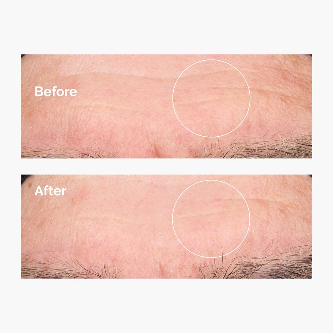 The Ordinary Hyaluronsäure-Serum Hyaluronsäure 2% + B5 - 30 ml