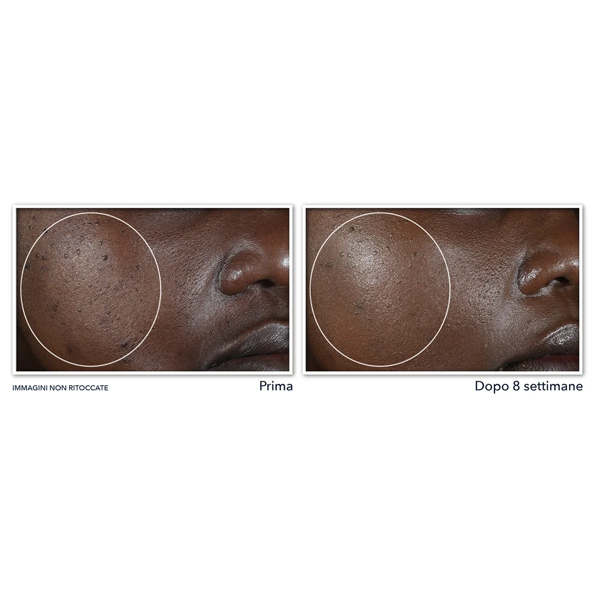 Multi Correxion Even Tone + Lift Crema Notte - Tratt.notte lifting viso , Tratt.viso notte illuminante, Tratt.notte antimacchie, Tratt. viso notte antimperfezioni