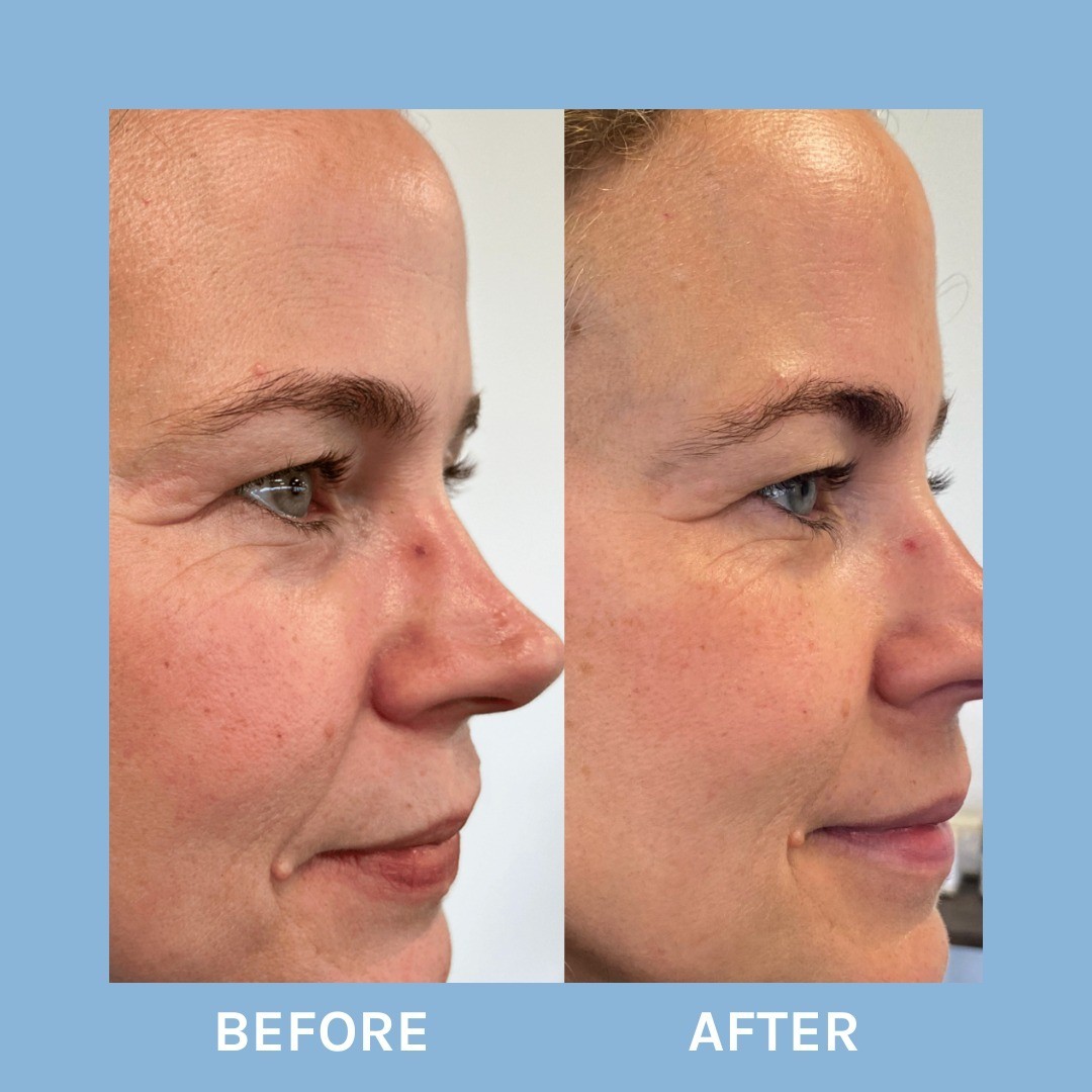 Evolve Organic Beauty Age Defying Lifting Serum