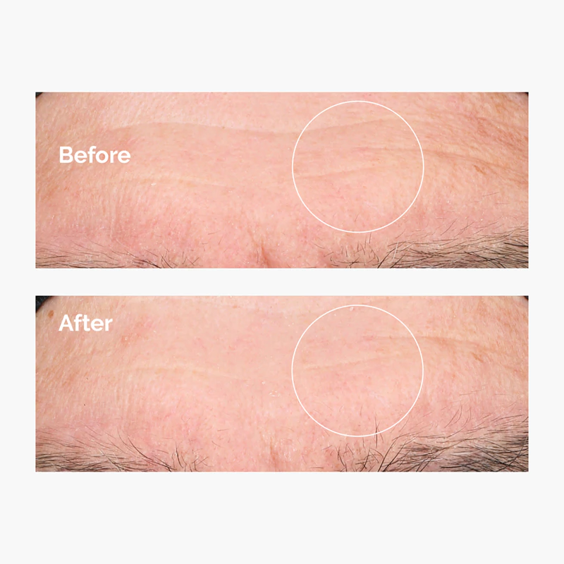 Sérum hidratante com ácido hialurônico 2% + vitamina B5 e ceramidas da The Ordinary