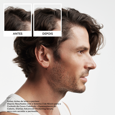 Nioxin Professionals Pack 2 Scalp Hair Natural Untreated Hair Thinning Coffret Cabelo Tratamento Cabelo Natural 1 ks 1 ks