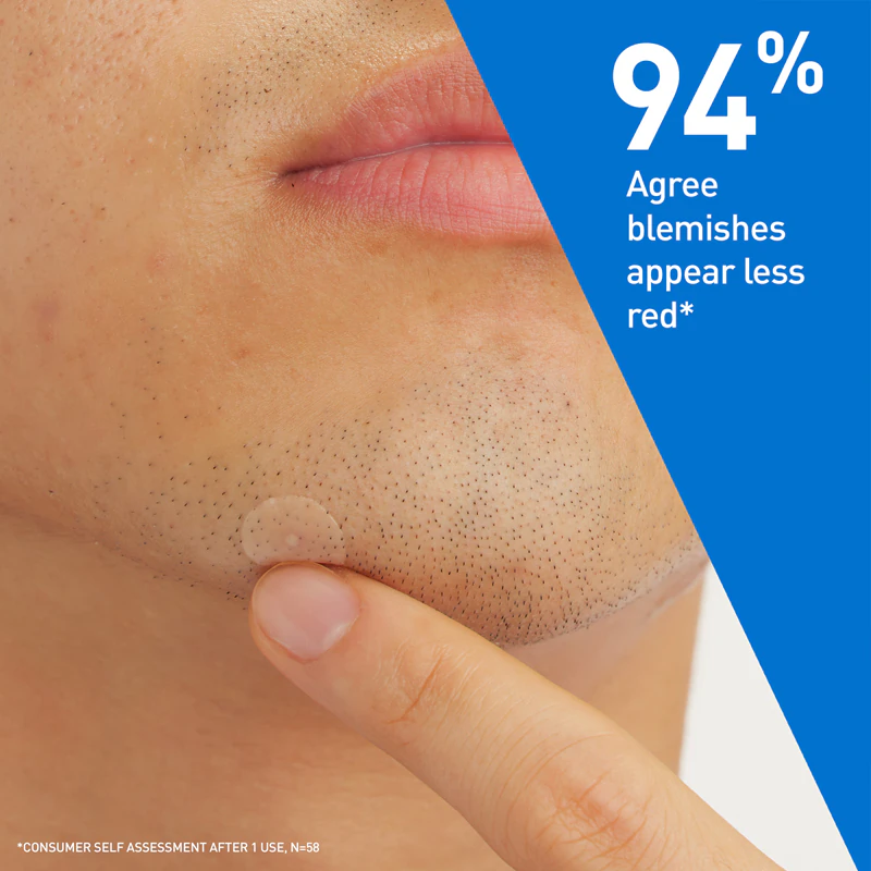 CeraVe Blemish Control Barrier -laastarit ongelmaiholle aknea vastaan