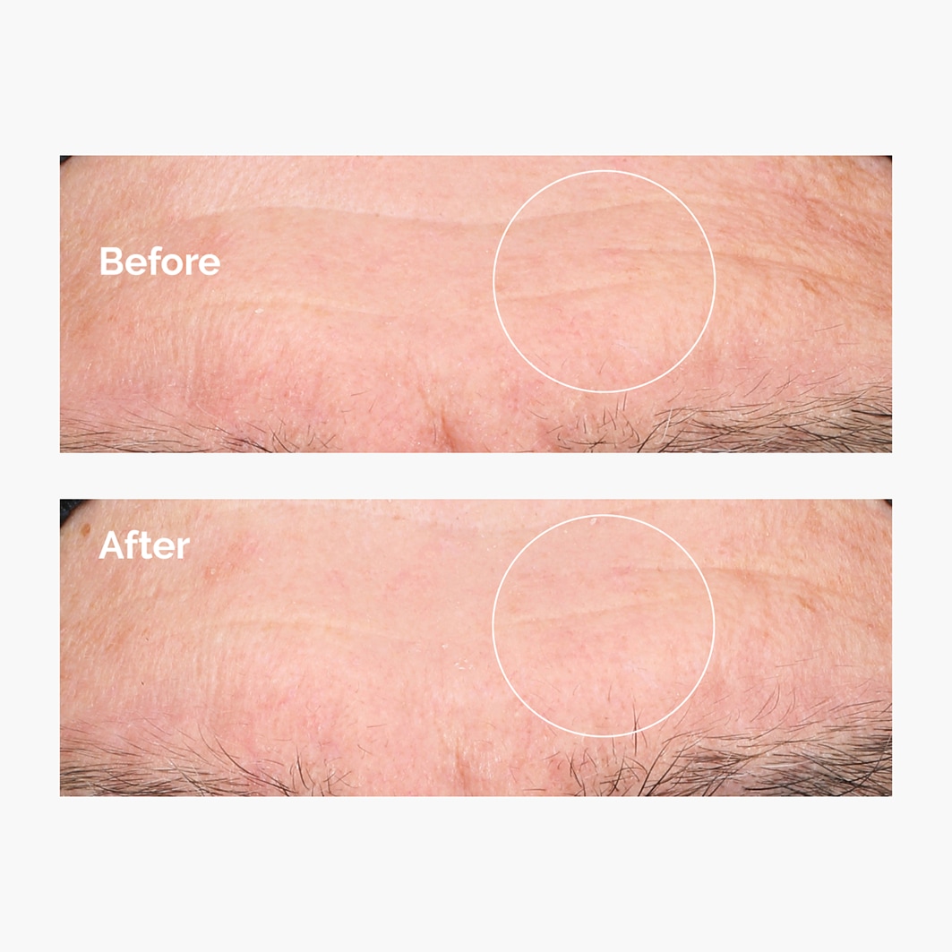 Het gewone Hyaluronsäure-Serum Hyaluronsäure 2% + B5 - 30 ml
