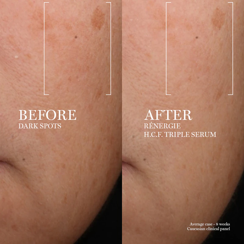 Lancôme Rénergie HCF Triple Serum gezichtsserum