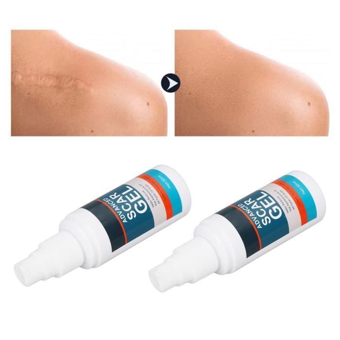Crème Cicatricielle Crème Anti-Cicatrices Gel Réparateur Pour Les Cicatrices De La Peau Douce Et Non Grasse Pour Les 45398