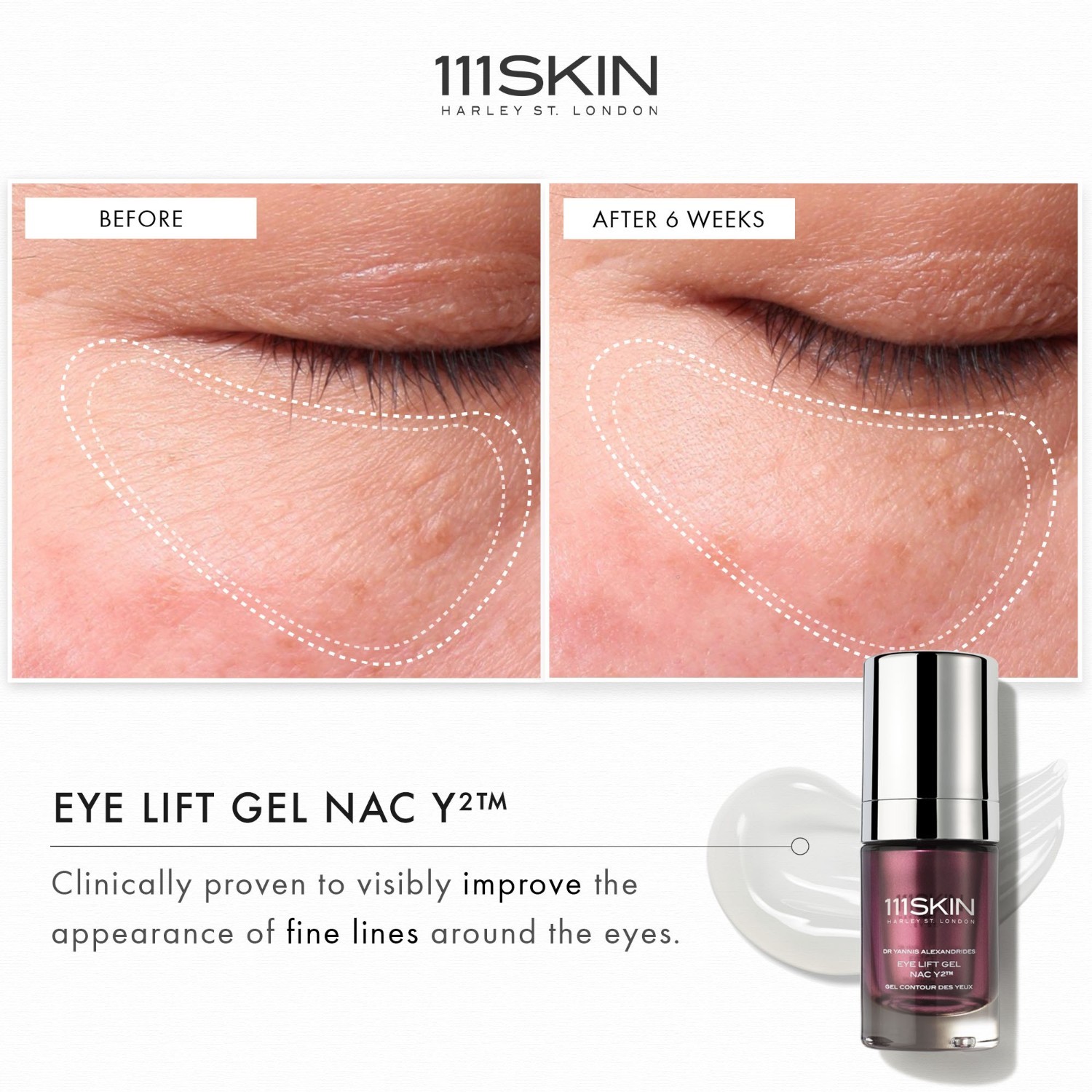 111Skin krema za oči NAC Y² gel za lifting očiju - 15 ml