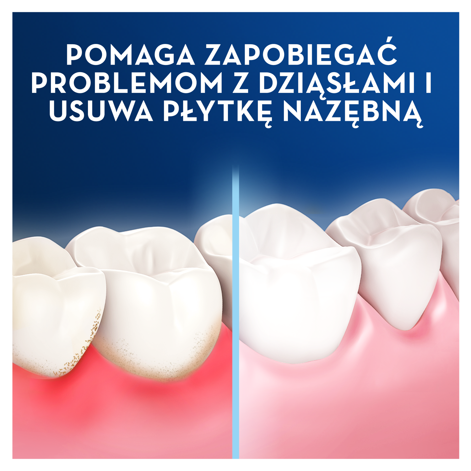 Oral-B Pro-Expert Advanced