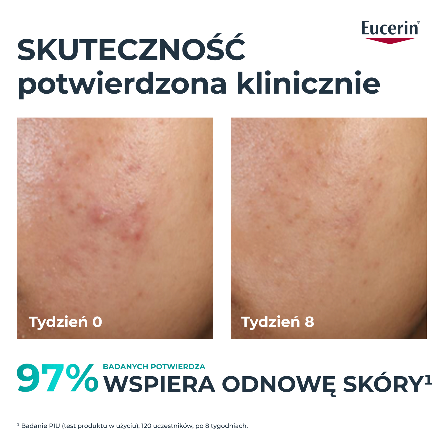 Eucerin DermoPure Clinico