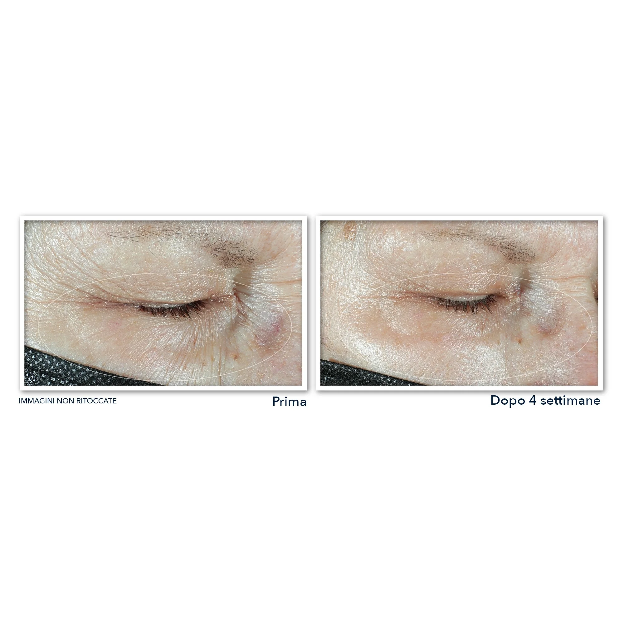 Multi Correxion Hydrate + Plump Crema Occhi - Contorno occhi antirughe, Contorno occhi idratante