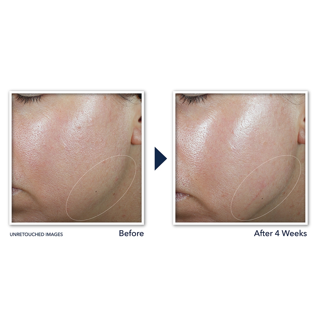RoC Crème - contour