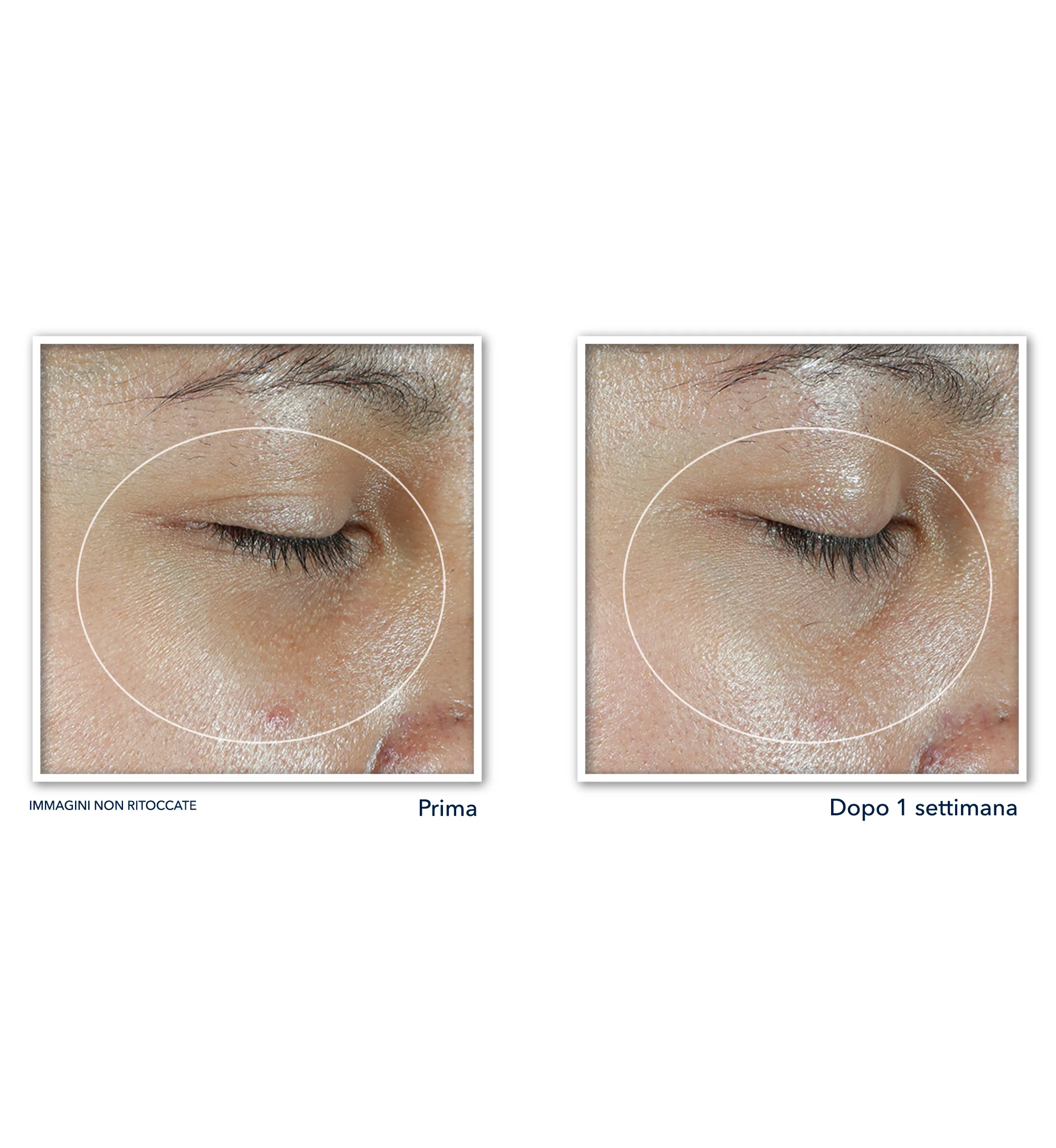 Multi Correxion Revive + Glow Eye Balm - Tratt.anti borse e occhiaie