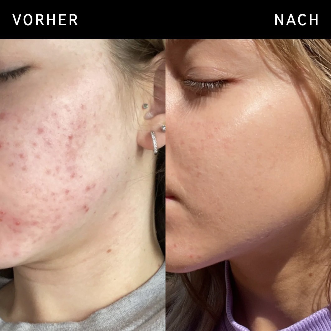 INKEY List Glowserum Serum s niacinamidom – 30 ml