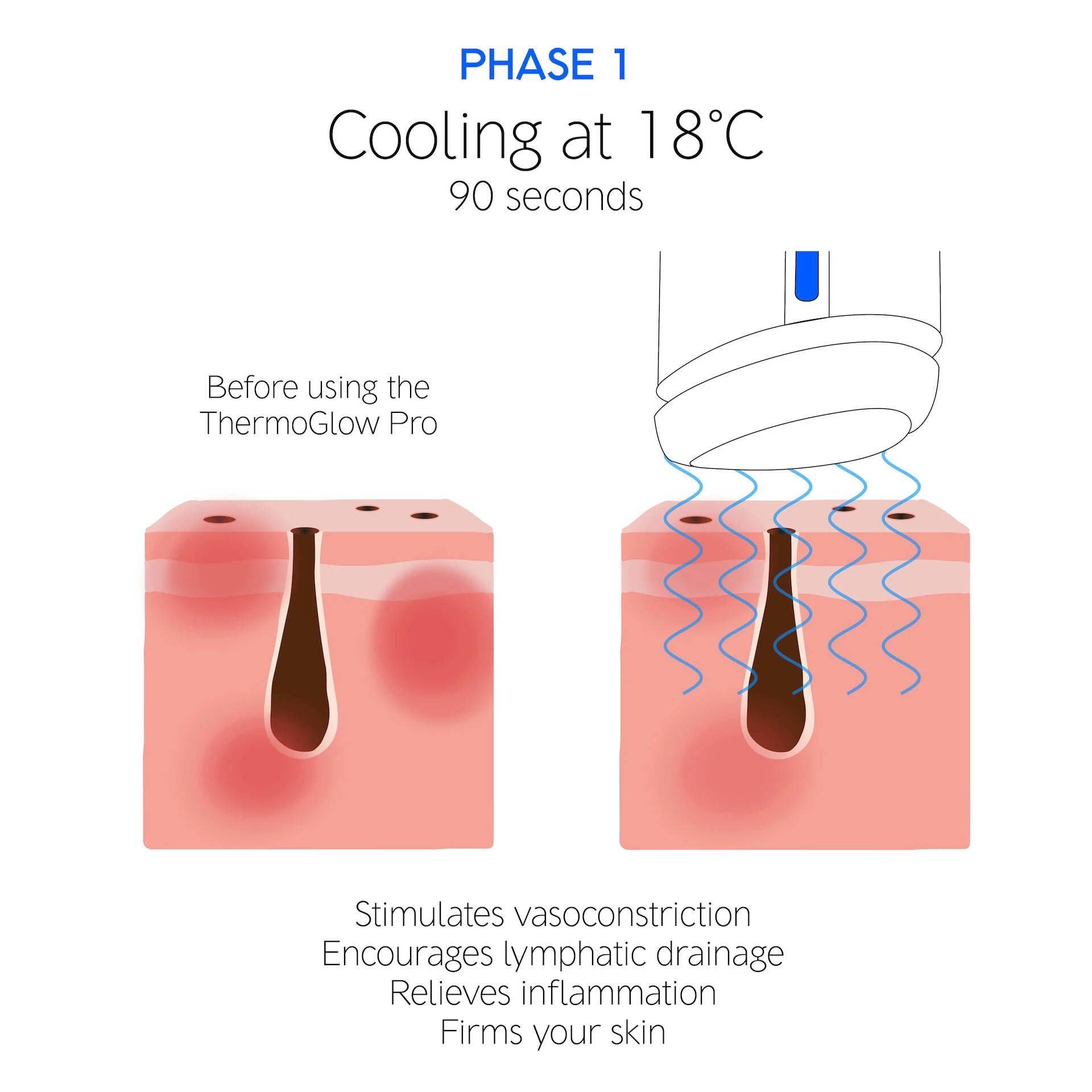 A ThermoGlow Pro - Dr. LEVY Svájc
