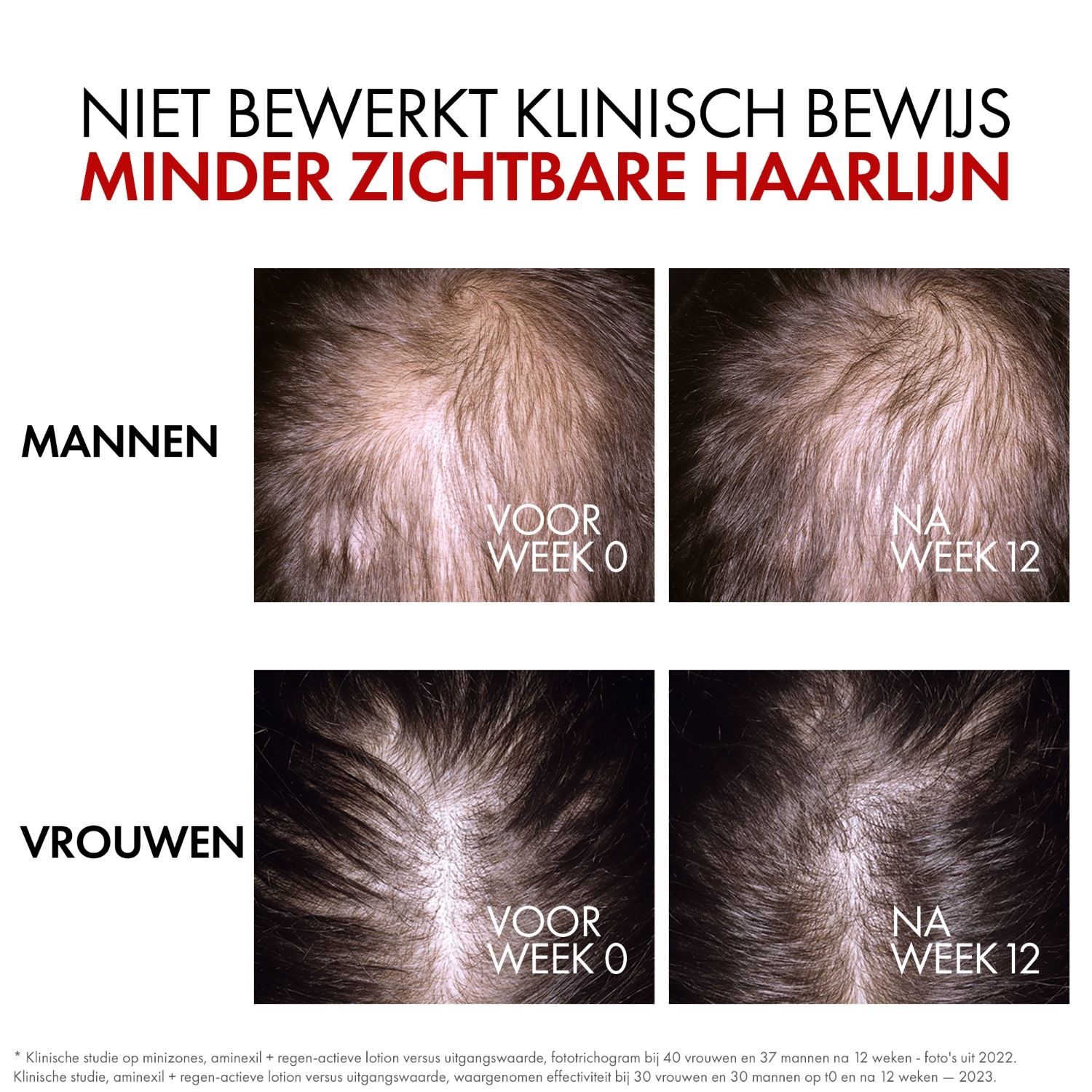 Vichy serum za kosu Dercos Aminexil Clinical REGEN Booster - 90 ml