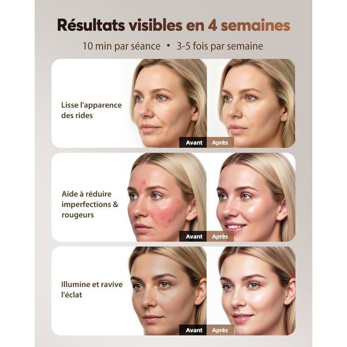 Draadloos LED-gezichtsmasker met koeling, 4 lichttherapiemodi (rood en infrarood 850 nm), afstandsbediening, batterijduur van 60 minuten