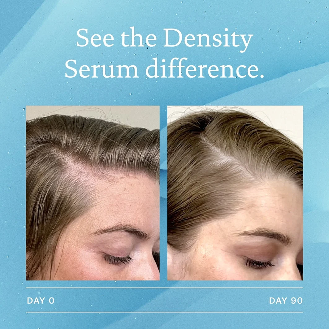 Scalp Care Scalp Care Density Serum - Siero Capelli, Trattamento Cuoio Capelluto