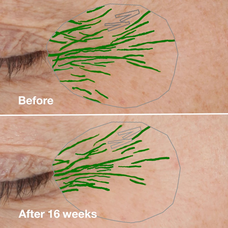 Clinique Smart Clinical™ Repair grumbu korekcijas serums