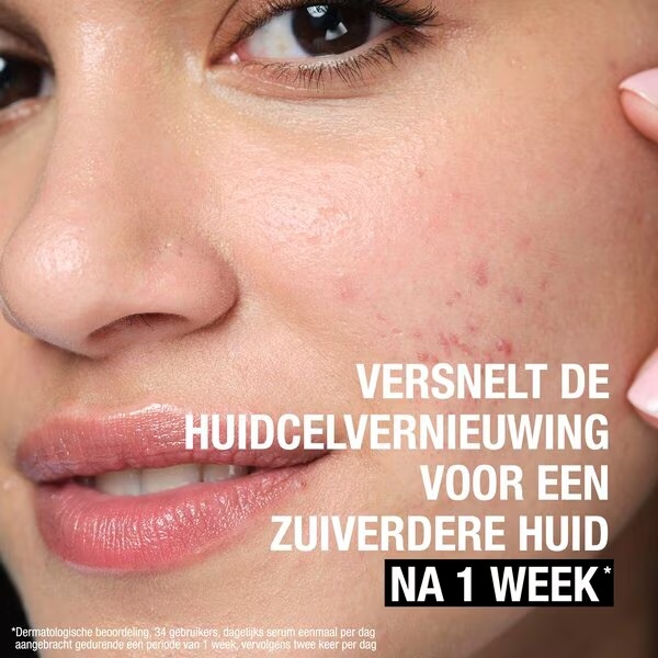 Neutrogena čistilni gel proti mozoljem+ 200 ml - za akne in nečisto kožo