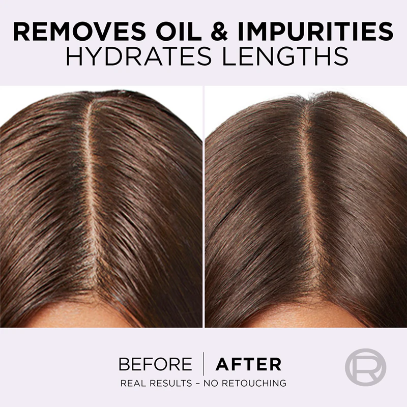 L'Oréal Paris Elseve Hyaluron Pure Feuchtigkeitsshampoo für fettige Kopfhaut und trockene Spitzen
