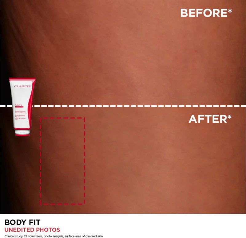 Clarins Body Fit Huidverzachtende Expert Verstevigende Crème tegen Cellulitis