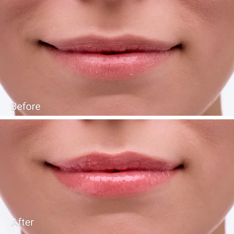 Notino Protetor Labial Hidratante com Proteção Solar: bálsamo labial protetor com propriedades hidratantes.