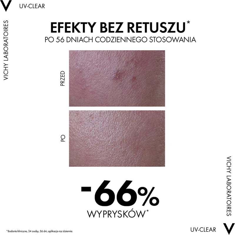 Vichy Capital Soleil UV-Clear Anti-Falten-Pflege für fettige, zu Akne neigende Haut