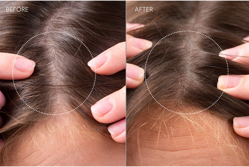 FOREO FAQ™ Sérum Probiótico para Recuperação do Couro Cabeludo e Cabelos Espessados: sérum probiótico para regeneração capilar e do couro cabeludo.