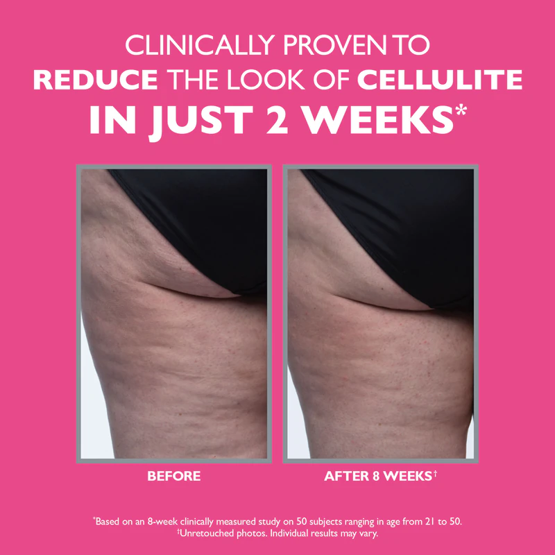 Peter Thomas Roth FIRMx Straffende Körpercreme für Cellulite