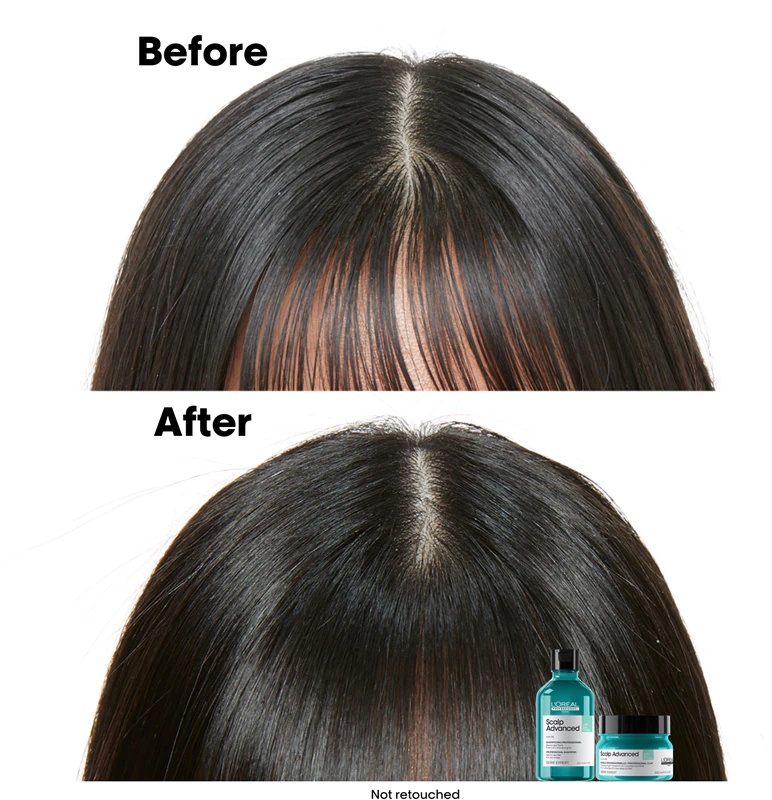 „L'Oréal Professionnel Serie Expert Scalp Advanced“ 2 viename šampūnas ir kaukė riebiems plaukams ir galvos odai