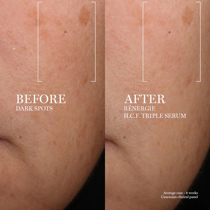 „Lancôme Rénergie HCF Triple Serum“ veido serumas