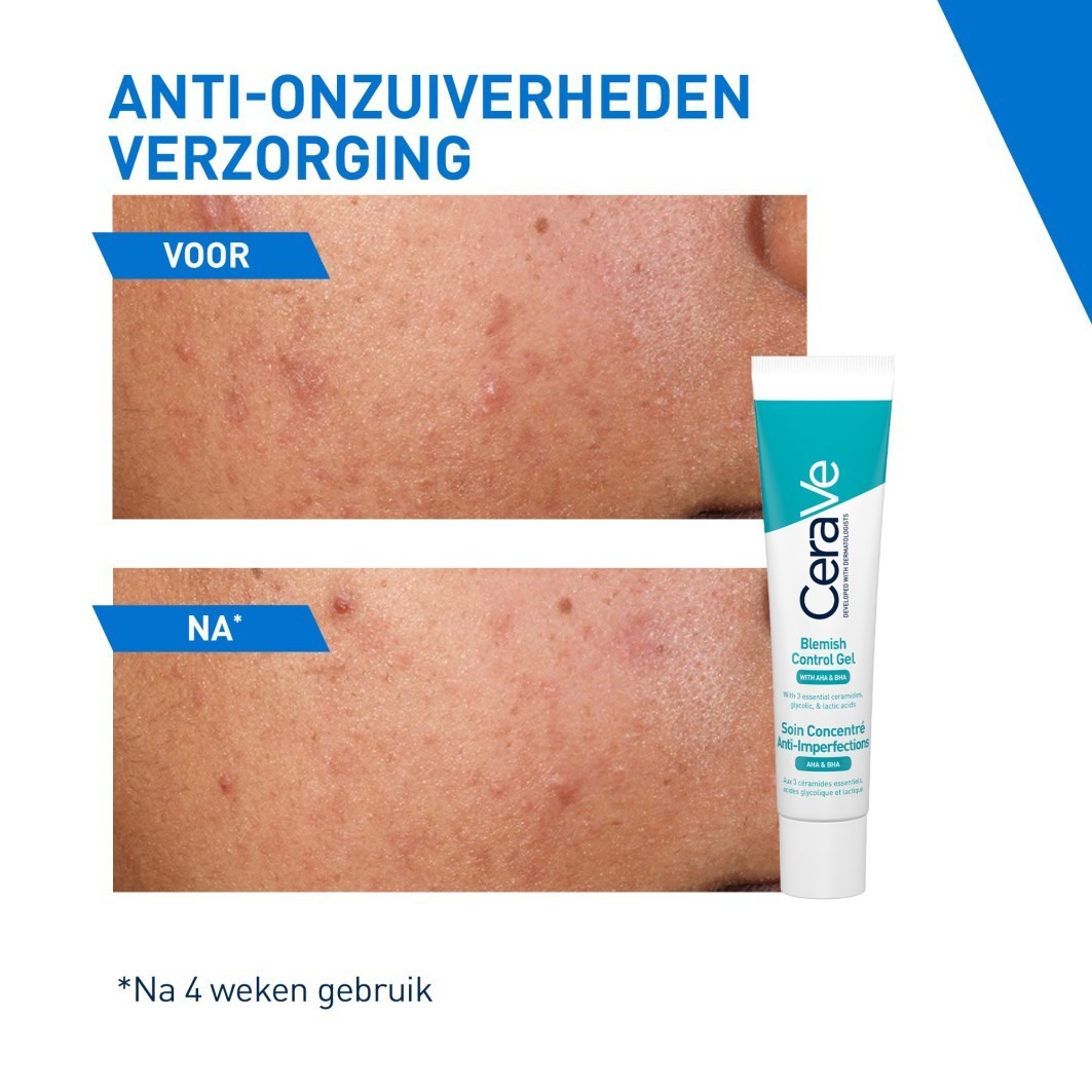CeraVe veido gelis nuo spuogų - 40 ml
