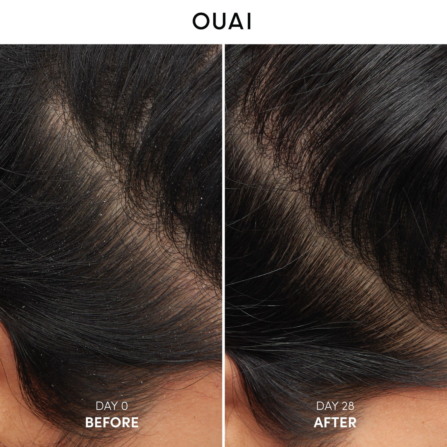 Ouai šampon proti prhljaju – 300 ml
