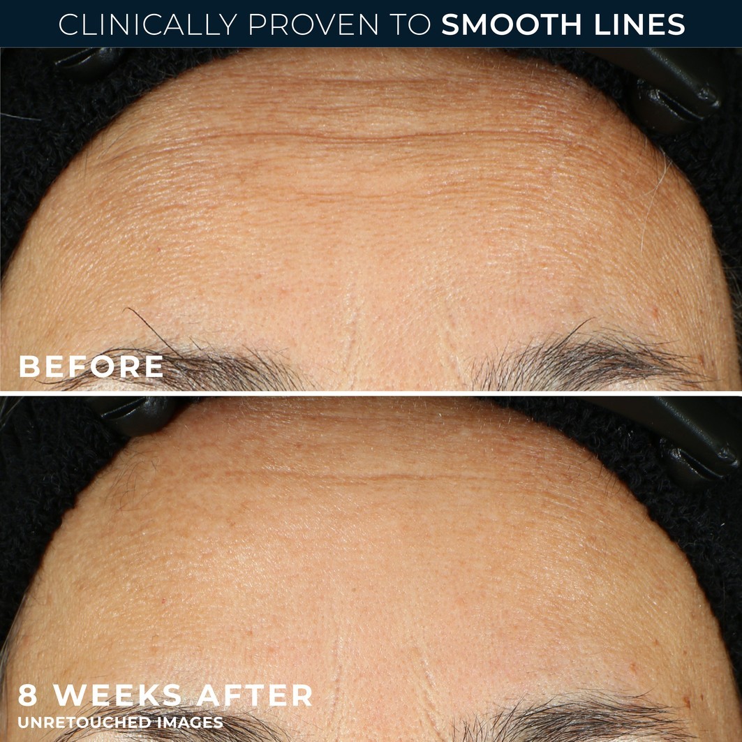 RoC Kosteuttava Serum Retinol Correxion Line Smoothing Night 30 Kapselia - 1 kpl