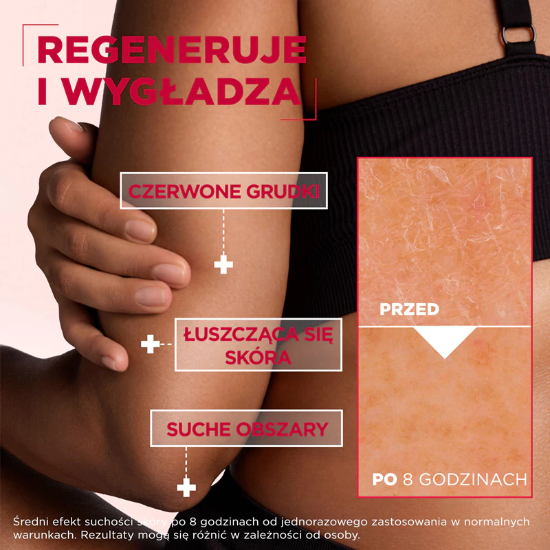 Mixa Mixa Body Care Creme corporal regenerador com ureia e centelha para pele muito seca