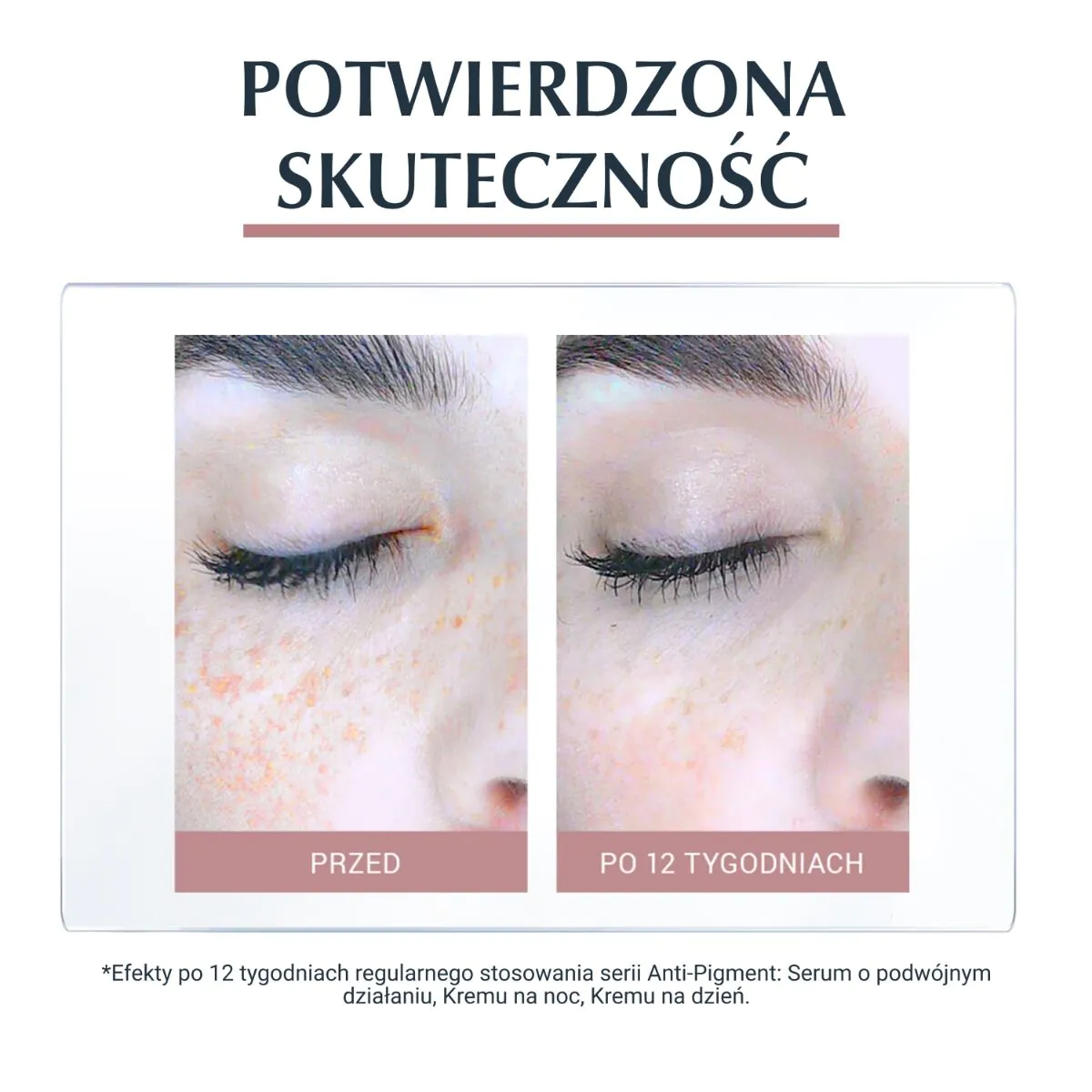 Eucerin Anti Pigment Serum o podwójnym Działaniu