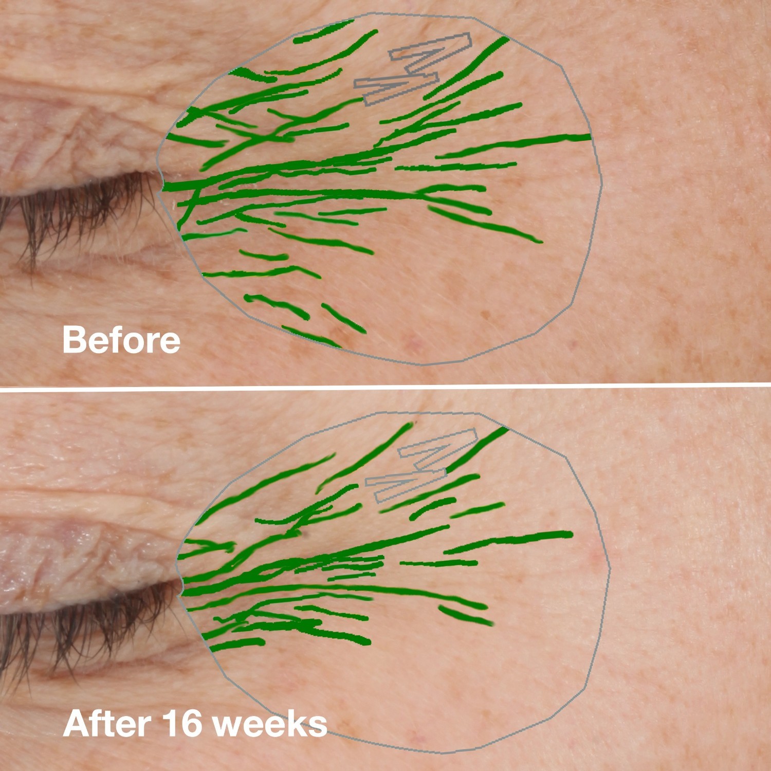 Clinique Anti-Aging-Pflege Clinique Smart CLINIQUE SMART CLINICAL REPAIR™ FALTENKORREKTUR-CREME - 15 ml