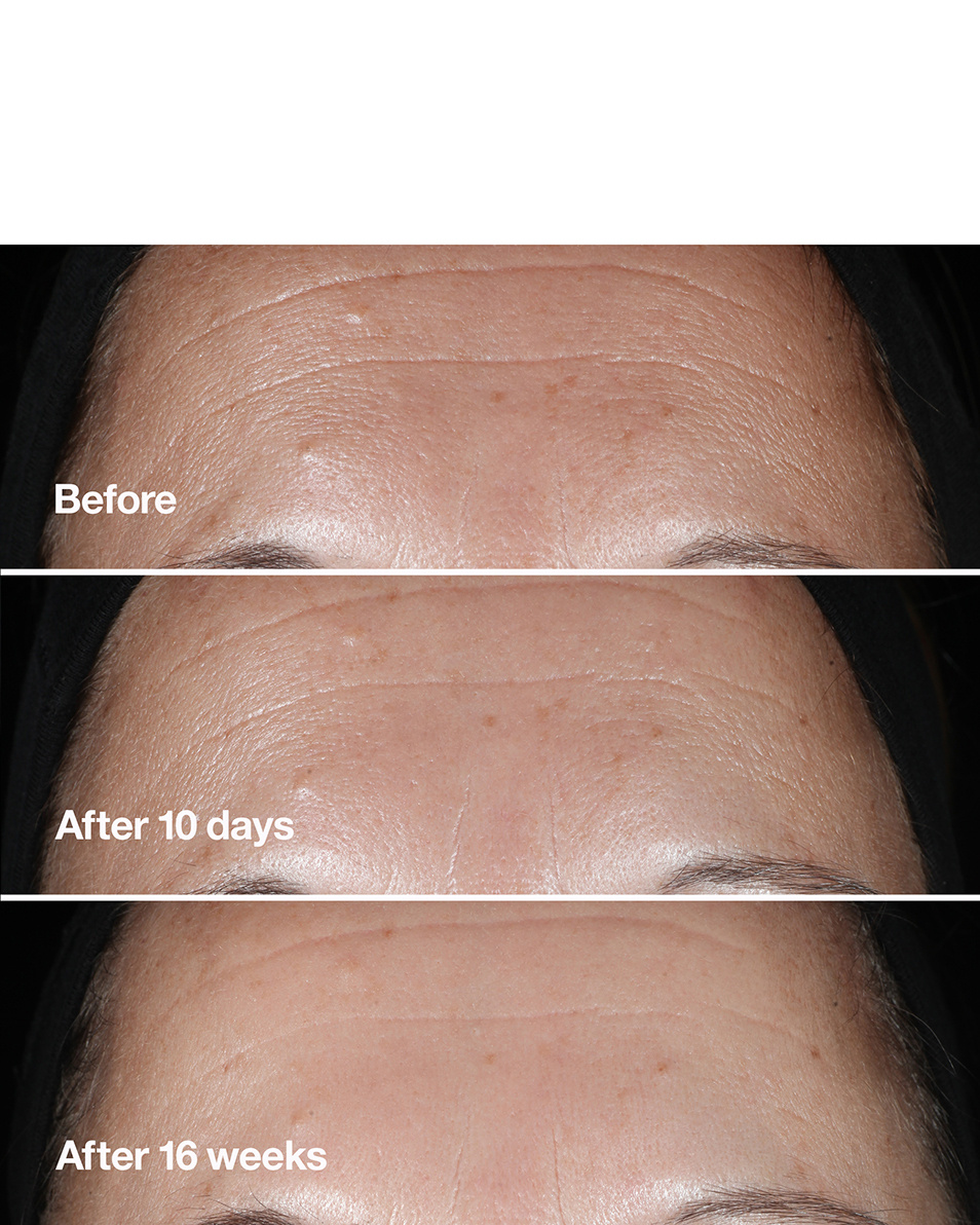 CLINIQUE CLINIQUE SMART CLINICAL REPAIR™ SER CORECTATOR PENTRU RIDURI SER ANTI-ÎMBĂTRÂNIRE