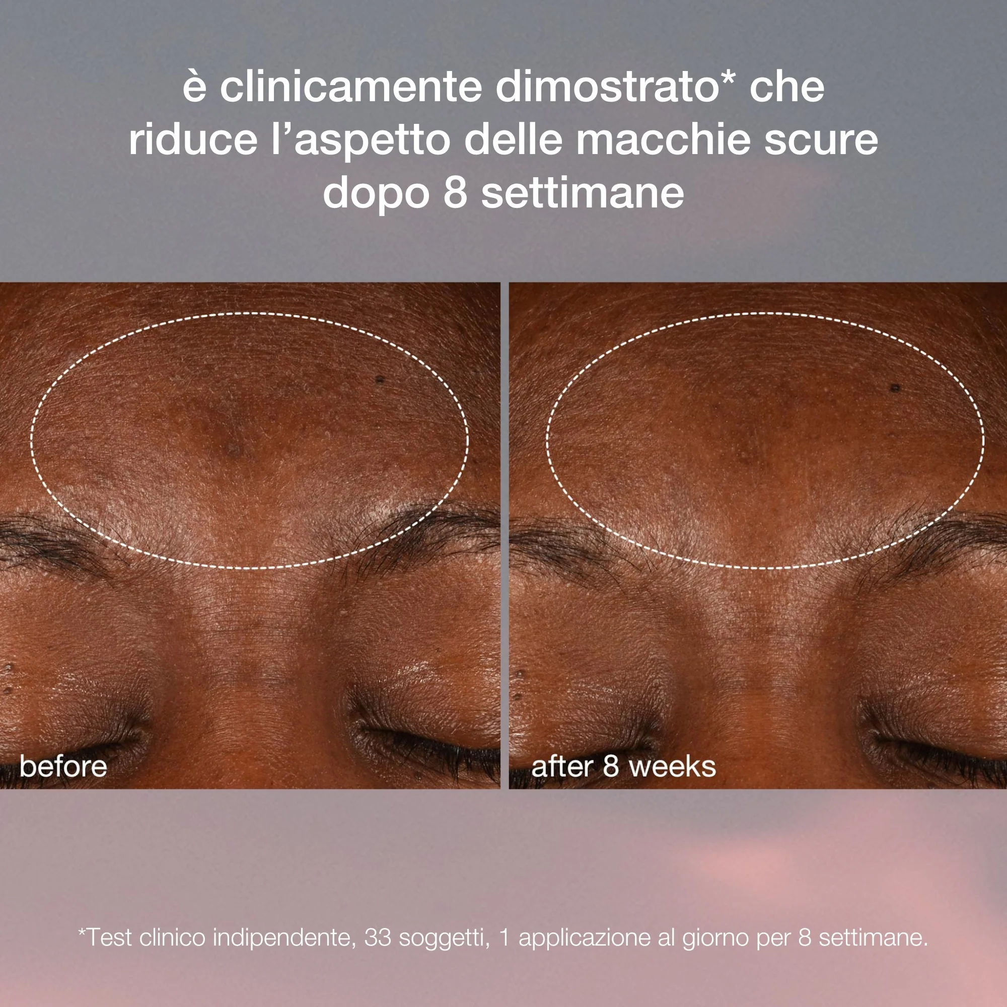 Dynamic Skin Dynamic Skin Recovery SPF50 - Crema viso giorno antirughe, Trattamenti Protettivi