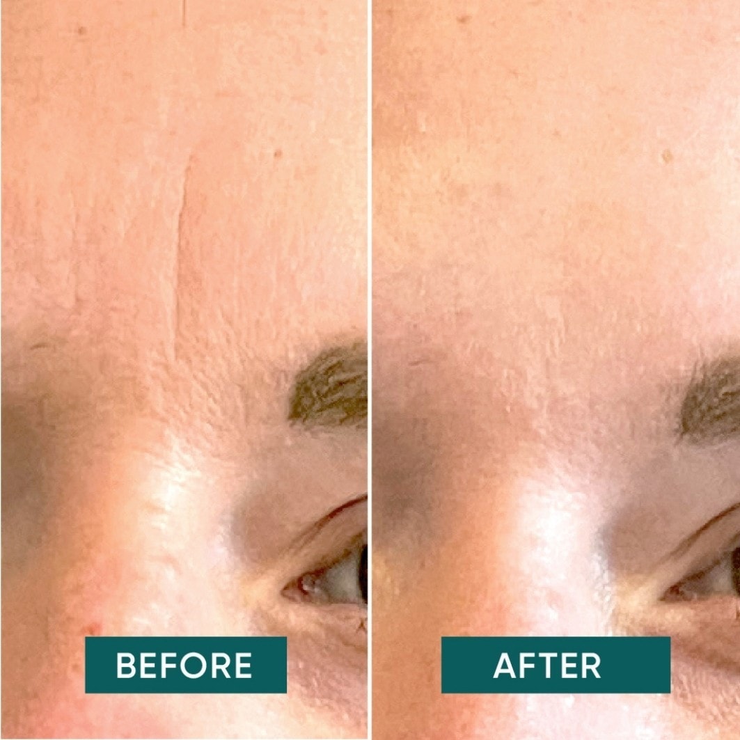 Mascarilla antiedad de albaricoque, discos faciales con ácido hialurónico – mini – 1 unidad