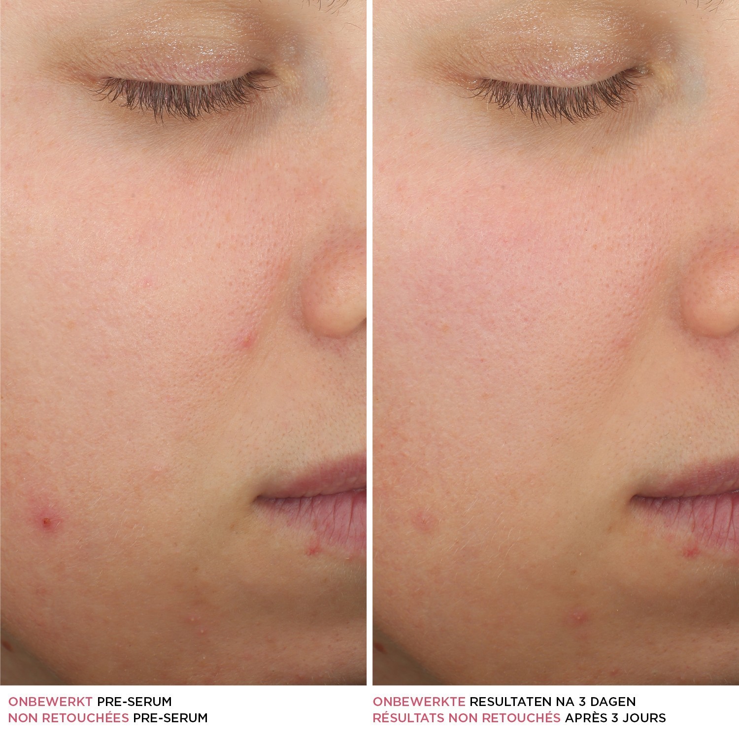 IT Cosmetics drėkinamasis serumas BYE BYE Blemish serumas -