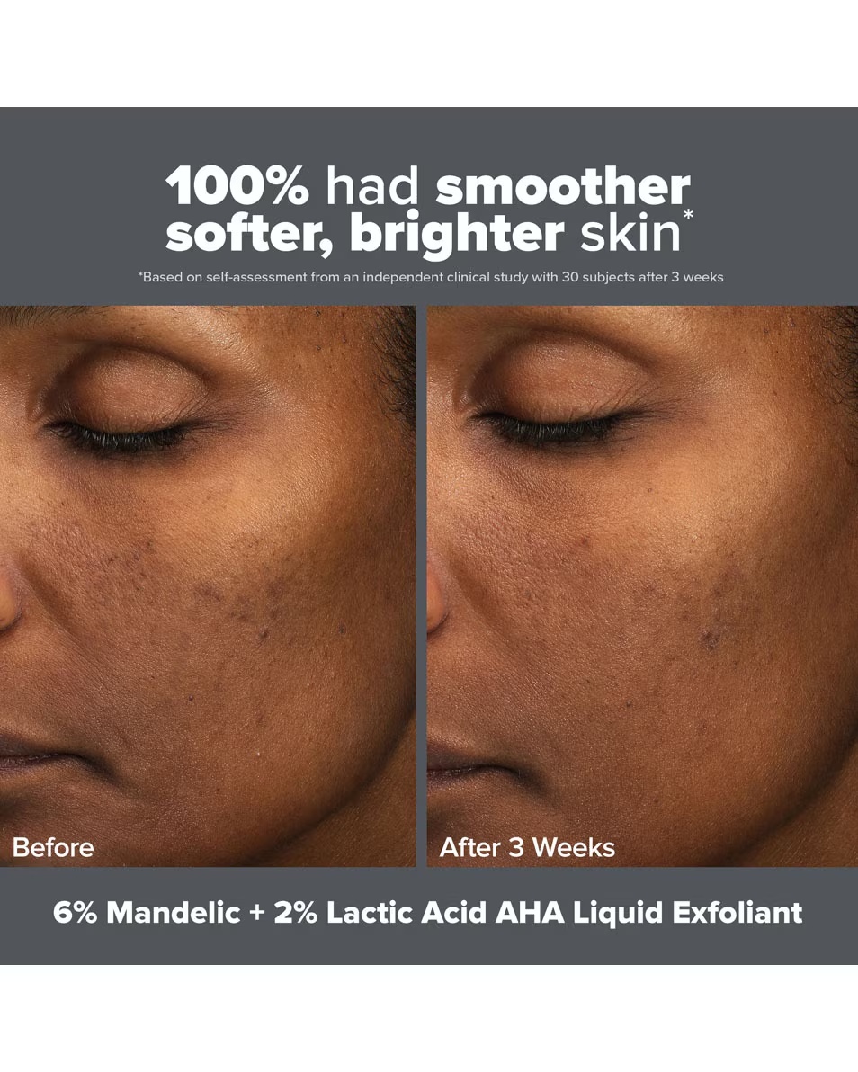 Paula's Choice SKIN PERFECTING SKIN PERFECTING 6% Μανδελικό οξύ 2% Γαλακτικό οξύ AHA Υγρή απολέπιση