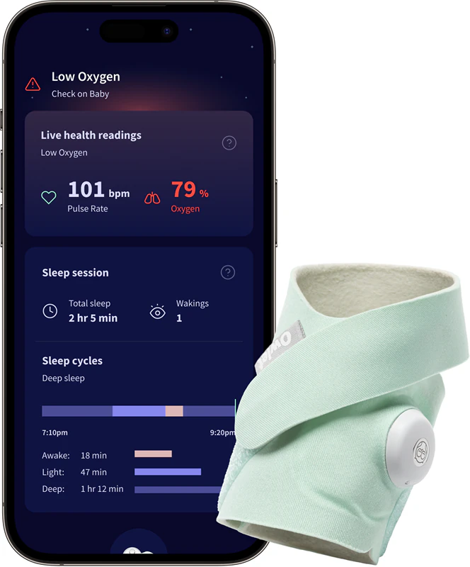 Meia inteligente Owlet Dream Sock para dispositivos médicos de 0 a 18 meses.