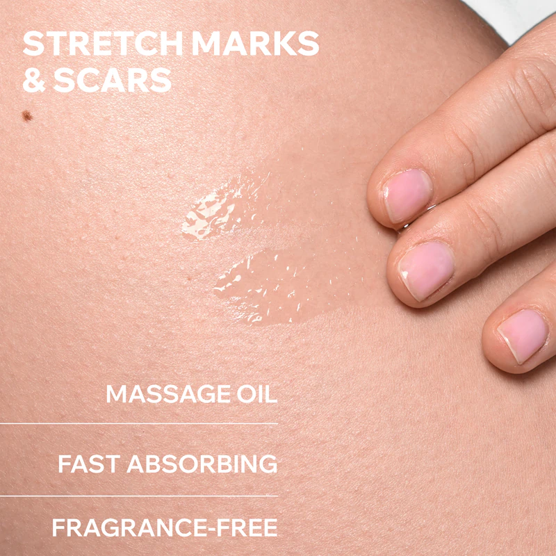 Uriage Bariéderm Cica Dermatologische Olie, voedende lichaamsolie tegen striemen