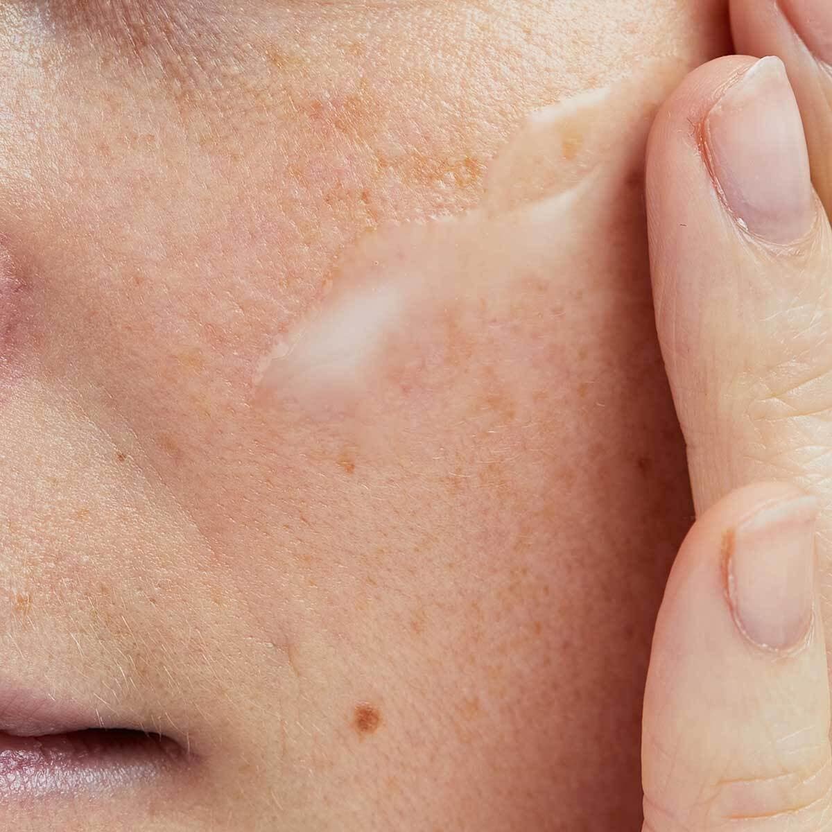 Sérum de ácido hialurónico de Pai Skincare para revitalizar la piel - 30 ml