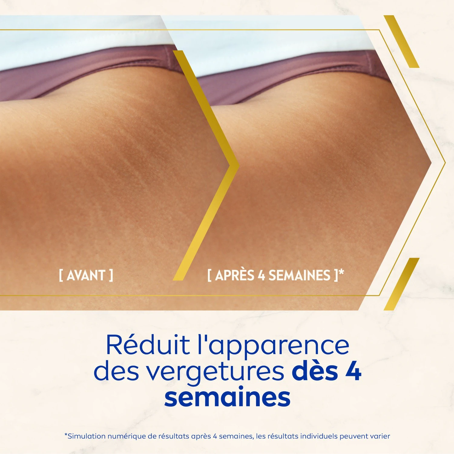 NIVEA Luminous 630 - Lait Corps Anti-taches et Anti-vergetures