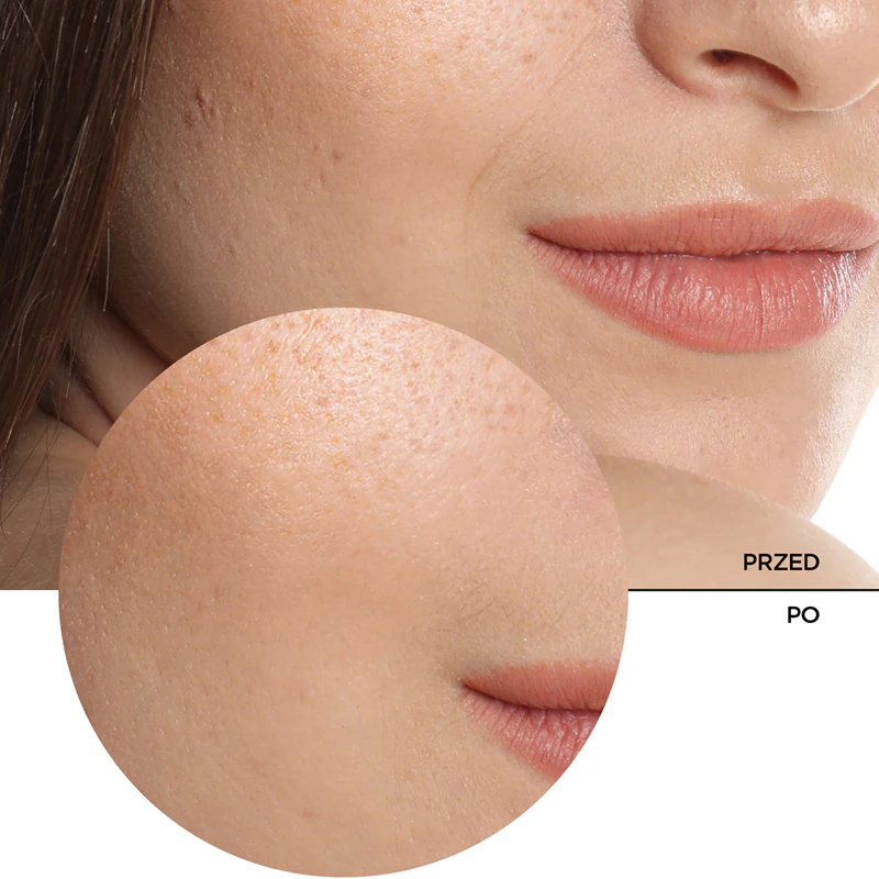 Revox B77 JUST Hyaluronsäure 5% Feuchtigkeitsfluid für Gesicht und Hals
