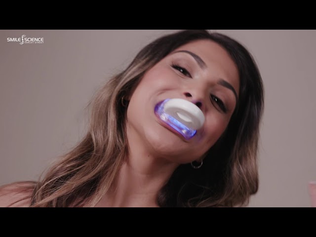 Smile Science Harley Street Professionele Tandenbleekset