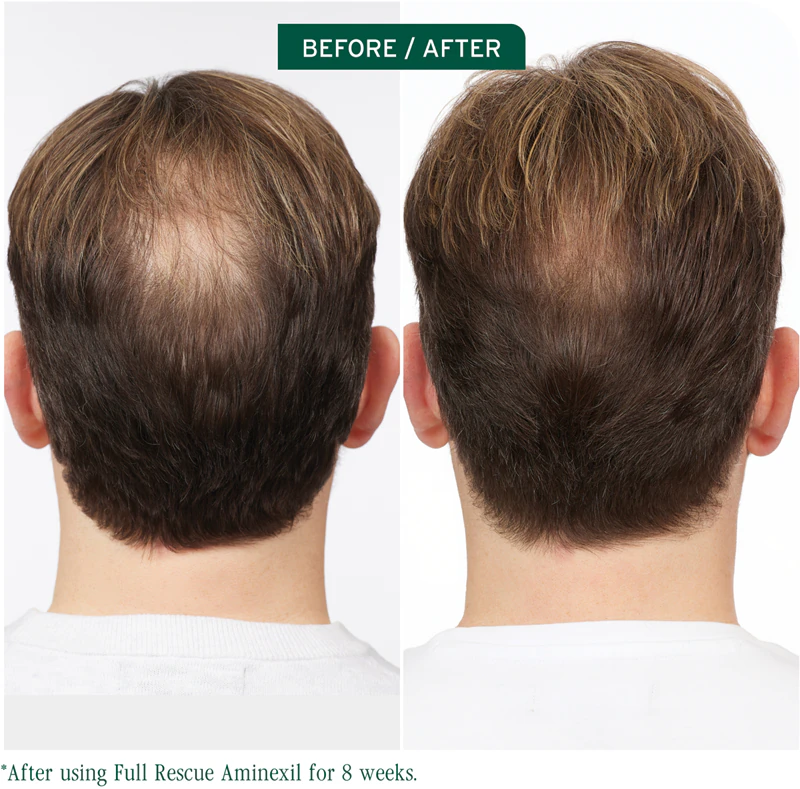 Biolage Full Rescue – Punktbehandlung gegen Haarausfall